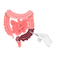 surgery.png